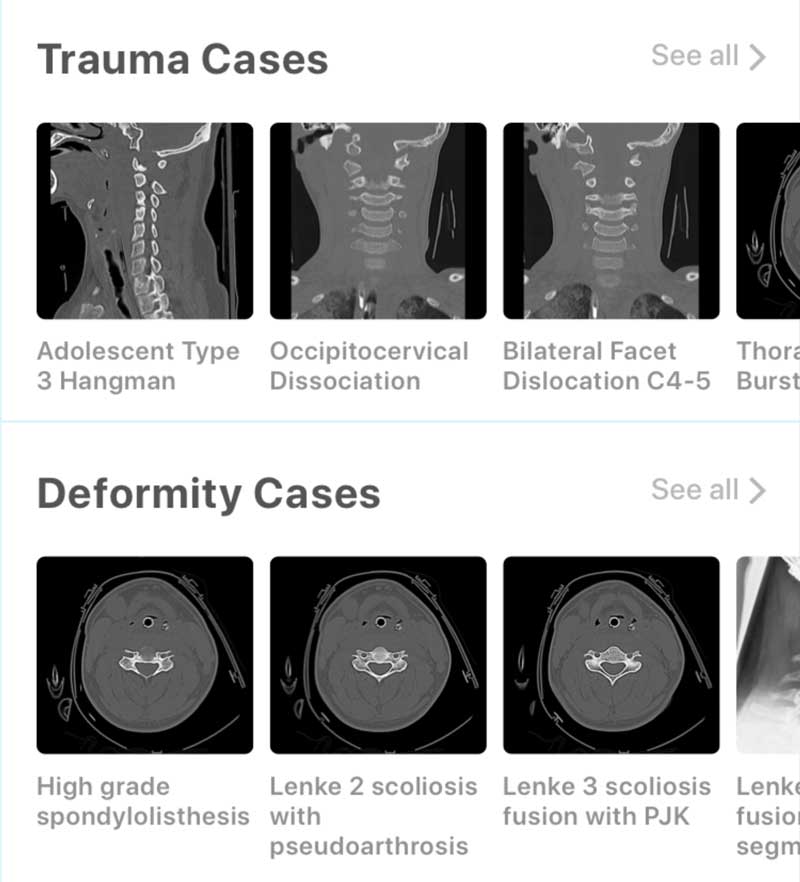 SpinED medical case studies with CT scans